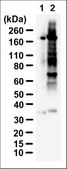 Anti-Phosphothreonine Antibody, clone RM102 clone RM102, from rabbit, purified by affinity chromatography