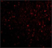 Anti-BRSK2 antibody produced in rabbit affinity isolated antibody, buffered aqueous solution
