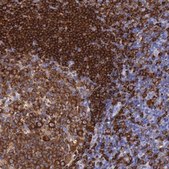 Anti-BTK antibody produced in rabbit Ab1, Prestige Antibodies® Powered by Atlas Antibodies, affinity isolated antibody, buffered aqueous glycerol solution