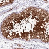 Anti-RPAP2 antibody produced in rabbit Prestige Antibodies® Powered by Atlas Antibodies, affinity isolated antibody, buffered aqueous glycerol solution