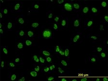 Monoclonal Anti-MLH1 antibody produced in mouse clone M1, purified immunoglobulin, buffered aqueous solution
