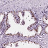 Anti-SLC45A3 antibody produced in rabbit Prestige Antibodies® Powered by Atlas Antibodies, affinity isolated antibody, buffered aqueous glycerol solution