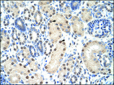 Anti-ANP32A (AB1) antibody produced in rabbit affinity isolated antibody