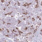 Anti-SLC4A4 antibody produced in rabbit Prestige Antibodies® Powered by Atlas Antibodies, affinity isolated antibody, buffered aqueous glycerol solution