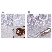 Anti-SEMG2 antibody produced in rabbit Prestige Antibodies® Powered by Atlas Antibodies, affinity isolated antibody, buffered aqueous glycerol solution