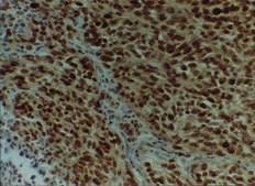 Anti-MGMT Antibody, clone MT3.1 clone MT3.1, Chemicon®, from mouse