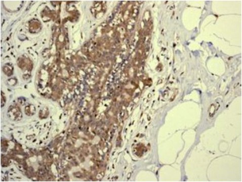 Anti-PSMA7, clone EPR5836, Rabbit Monoclonal Antibody clone EPR5836, from rabbit