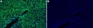 Anti-α1-Antitrypsin Antibody, clone 1K23 ZooMAb® Rabbit Monoclonal recombinant, expressed in HEK 293 cells