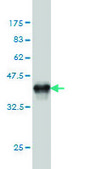 Monoclonal Anti-PSMD5 antibody produced in mouse clone 3E2, purified immunoglobulin, buffered aqueous solution