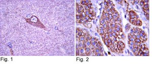 Anti-TrkA Antibody Upstate®, from rabbit