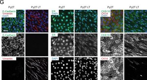 Monoclonal Anti-Vimentin antibody produced in mouse clone LN-6, ascites fluid