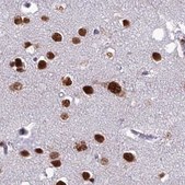 Anti-DDX1 antibody produced in rabbit Prestige Antibodies® Powered by Atlas Antibodies, affinity isolated antibody, buffered aqueous glycerol solution