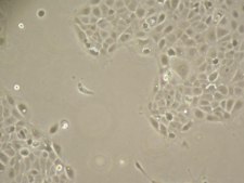 UM-SCC-47 HPV-16 Positive Squamous Carcinoma Cell Line suitable in vitro model of H&amp;N carcinoma studies