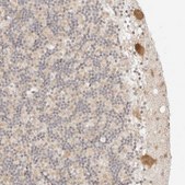 Anti-RPS6KL1 antibody produced in rabbit Prestige Antibodies® Powered by Atlas Antibodies, affinity isolated antibody, buffered aqueous glycerol solution, ab2