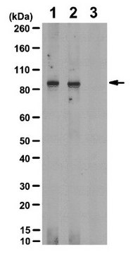 Anti-phospho-IGF-1R (Tyr1161/Tyr1165/Tyr1166) Antibody from rabbit, purified by affinity chromatography