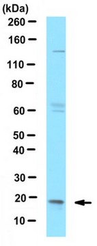 Anti-dUTPase Antibody from rabbit