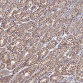 Anti-SGMS1 antibody produced in rabbit Prestige Antibodies® Powered by Atlas Antibodies, affinity isolated antibody, buffered aqueous glycerol solution