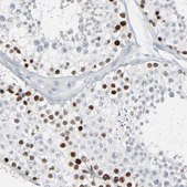 Anti-SAGE1 antibody produced in rabbit Ab2, Prestige Antibodies® Powered by Atlas Antibodies, affinity isolated antibody, buffered aqueous glycerol solution