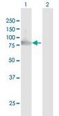 Anti-SUPV3L1 antibody produced in mouse IgG fraction of antiserum, buffered aqueous solution