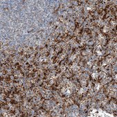 Anti-TBXAS1 antibody produced in rabbit Prestige Antibodies® Powered by Atlas Antibodies, affinity isolated antibody, buffered aqueous glycerol solution