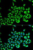 Anti-GSTP1 antibody produced in rabbit