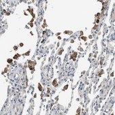 Anti-SLC25A20 antibody produced in rabbit Prestige Antibodies® Powered by Atlas Antibodies, affinity isolated antibody, buffered aqueous glycerol solution