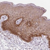 Anti-RAB22A antibody produced in rabbit Prestige Antibodies® Powered by Atlas Antibodies, affinity isolated antibody, buffered aqueous glycerol solution