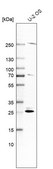 Anti-SPC25 antibody produced in rabbit Prestige Antibodies® Powered by Atlas Antibodies, affinity isolated antibody, buffered aqueous glycerol solution