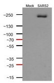 Anti-SARS-CoV-1/2 S Protein Antibody, clone 2B3E5 ZooMAb® Mouse Monoclonal recombinant, expressed in HEK 293 cells