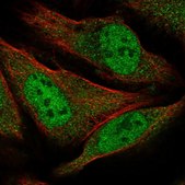 Anti-GEMIN8 antibody produced in rabbit Prestige Antibodies® Powered by Atlas Antibodies, affinity isolated antibody, buffered aqueous glycerol solution