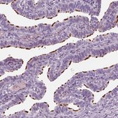 Anti-HYDIN antibody produced in rabbit Prestige Antibodies® Powered by Atlas Antibodies, affinity isolated antibody