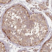 Anti-MADD antibody produced in rabbit Prestige Antibodies® Powered by Atlas Antibodies, affinity isolated antibody, buffered aqueous glycerol solution