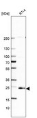 Anti-ARL15 antibody produced in rabbit Prestige Antibodies® Powered by Atlas Antibodies, affinity isolated antibody
