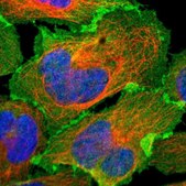 Anti-EPB41L2 antibody produced in rabbit Prestige Antibodies® Powered by Atlas Antibodies, affinity isolated antibody, buffered aqueous glycerol solution