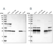 Anti-ECHS1 antibody produced in rabbit Prestige Antibodies® Powered by Atlas Antibodies, affinity isolated antibody, buffered aqueous glycerol solution, Ab1