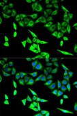 Anti-HADHA antibody produced in rabbit