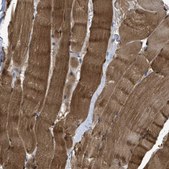 Anti-APOBEC2 antibody produced in rabbit Prestige Antibodies® Powered by Atlas Antibodies, affinity isolated antibody, buffered aqueous glycerol solution
