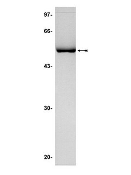 JNK2&#945;2/SAPK1a Protein, active, 10 &#181;g Active, N-terminal His-tagged, full length human JNK2&#945;2/SAPK1a, for use in Kinase Assays.