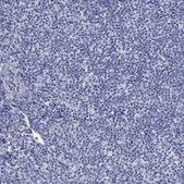 Anti-MGST3 antibody produced in rabbit Prestige Antibodies® Powered by Atlas Antibodies, affinity isolated antibody, buffered aqueous glycerol solution