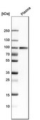 Anti-C1S antibody produced in rabbit Prestige Antibodies® Powered by Atlas Antibodies, affinity isolated antibody, buffered aqueous glycerol solution