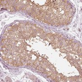 Anti-KIF5C antibody produced in rabbit Prestige Antibodies® Powered by Atlas Antibodies, affinity isolated antibody, buffered aqueous glycerol solution