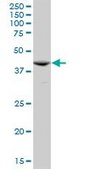 Anti-ACY1 antibody produced in mouse purified immunoglobulin, buffered aqueous solution