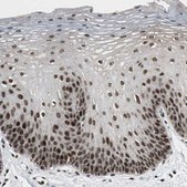 Anti-CDK9 antibody produced in rabbit Prestige Antibodies® Powered by Atlas Antibodies, affinity isolated antibody, buffered aqueous glycerol solution