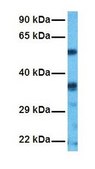 Anti-SLC38A2, (N-terminal) antibody produced in rabbit affinity isolated antibody