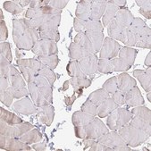Anti-MYL7 antibody produced in rabbit Prestige Antibodies® Powered by Atlas Antibodies, affinity isolated antibody, buffered aqueous glycerol solution