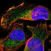 Anti-SLC27A4 antibody produced in rabbit Prestige Antibodies® Powered by Atlas Antibodies, affinity isolated antibody, buffered aqueous glycerol solution
