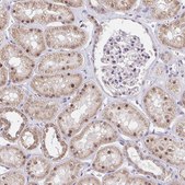 Anti-RFC4 antibody produced in rabbit Prestige Antibodies® Powered by Atlas Antibodies, affinity isolated antibody, buffered aqueous glycerol solution