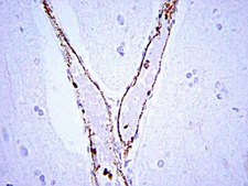 Anti-von Willebrand Factor Antibody Chemicon®, from rabbit