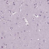 Anti-TBC1D10C antibody produced in rabbit Prestige Antibodies® Powered by Atlas Antibodies, affinity isolated antibody, buffered aqueous glycerol solution