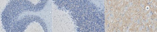 Anti-DYRK1A Antibody, clone 7F3 clone 7F3, from mouse